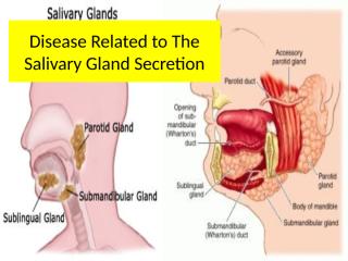 Disease Related to The Salivary Gland (tjin).pptx